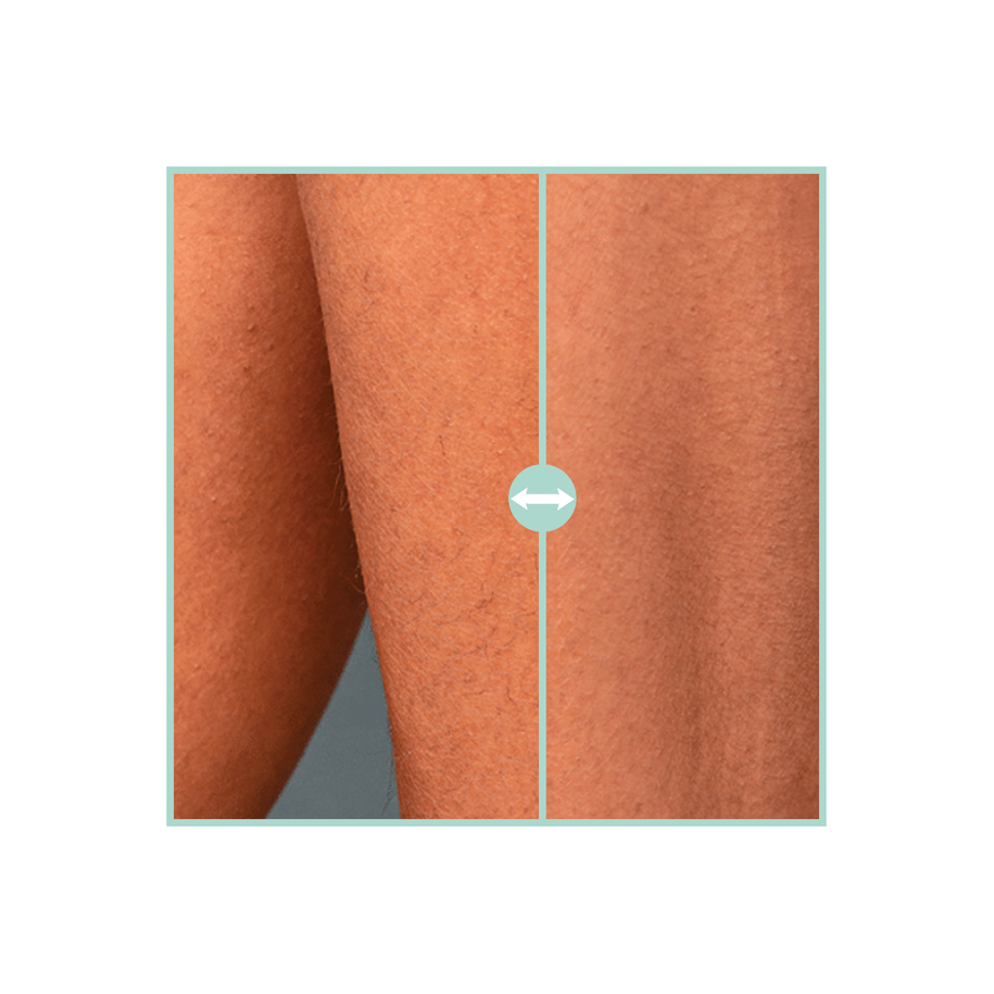 Haarreduzierendes Gel nach der Epilation 150ml