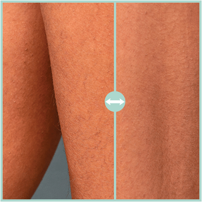 1 + 1 Gratis Haarreduzierendes Gel nach der Epilation 150ml